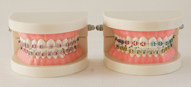 TM-B9-01 Ortho Metal Brcker